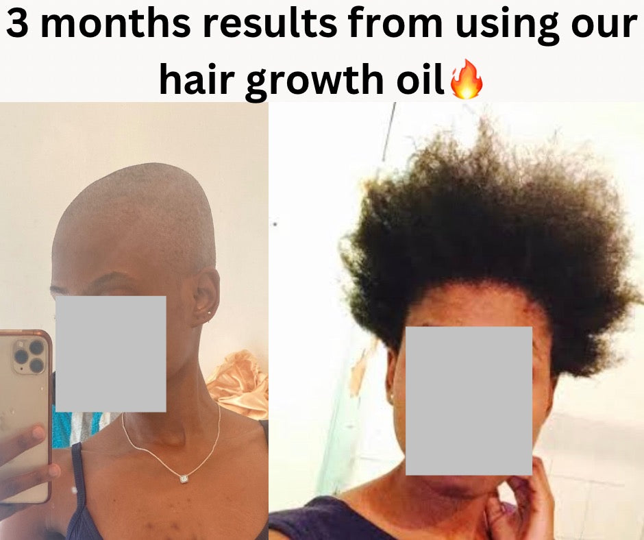 Fast Hair Growth Oil
