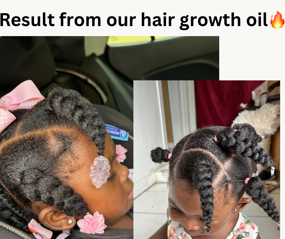 Kid’s Hair Growth oil