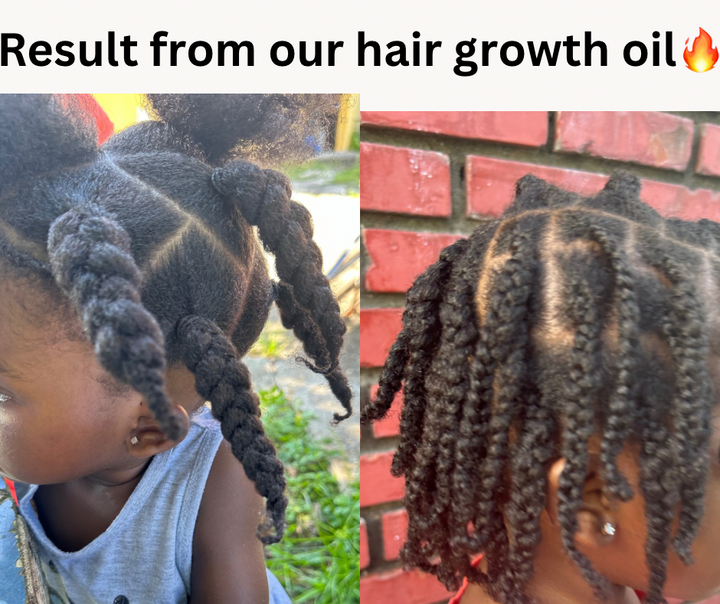 Kid’s Hair Growth oil