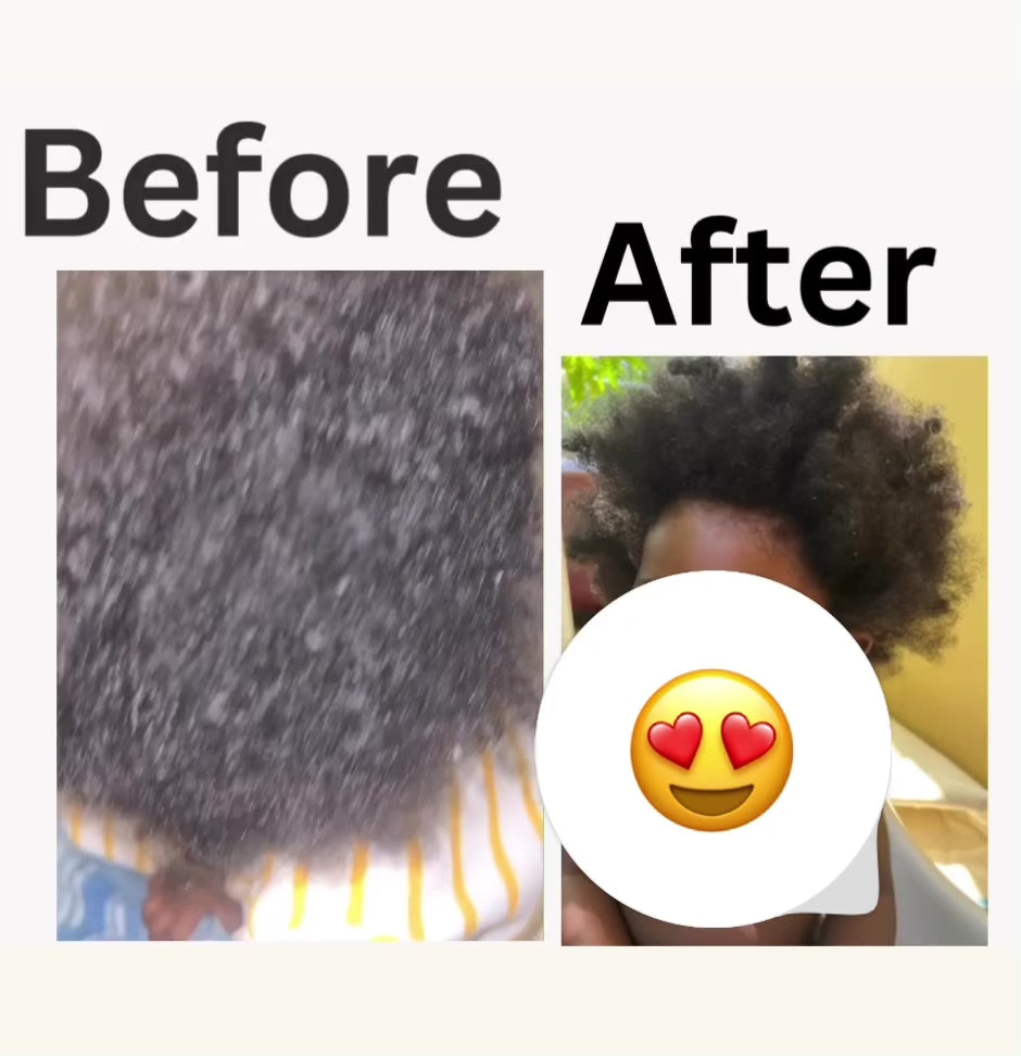 Kid’s Hair Growth oil