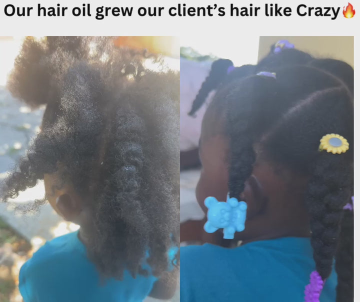 Kid’s Hair Growth oil